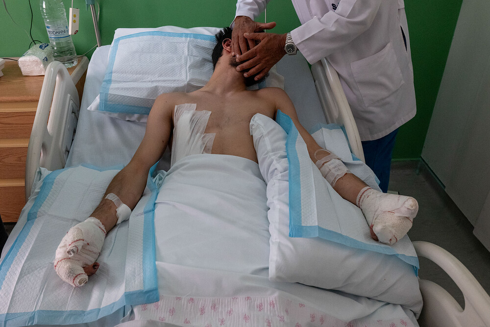 A member of Hezbollah, injured in the hands and face by the explosion of his pager, in Beirut. On 17 and 18 September 2024, thousands of handheld pagers and hundreds of walkie-talkies intended for use by Hezbollah exploded simultaneously in two separate events across Lebanon and Syria in an Israeli attack. The attack killed at least 42 people, including at least 12 civilians, and wounded more than 3,000. TO CHECK Un membre du Hezbollah, blessés aux mains et au visage, par l’explosion de son bipper, à Beyrouth.